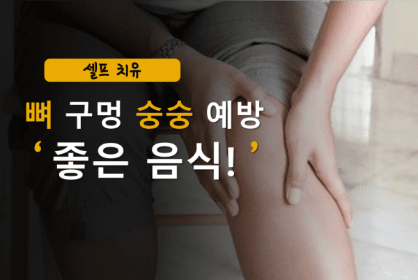 골다공증 앓고 있는 여성이 골다공증에 좋은 음식 찾는 모습